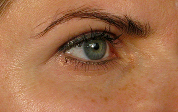 eyes-before-1