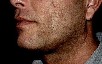 face-before